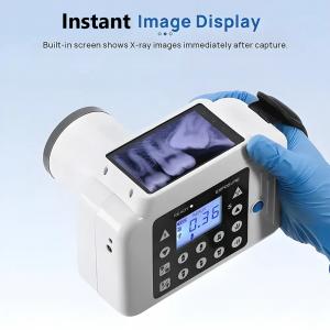 portable dental x ray with sensor